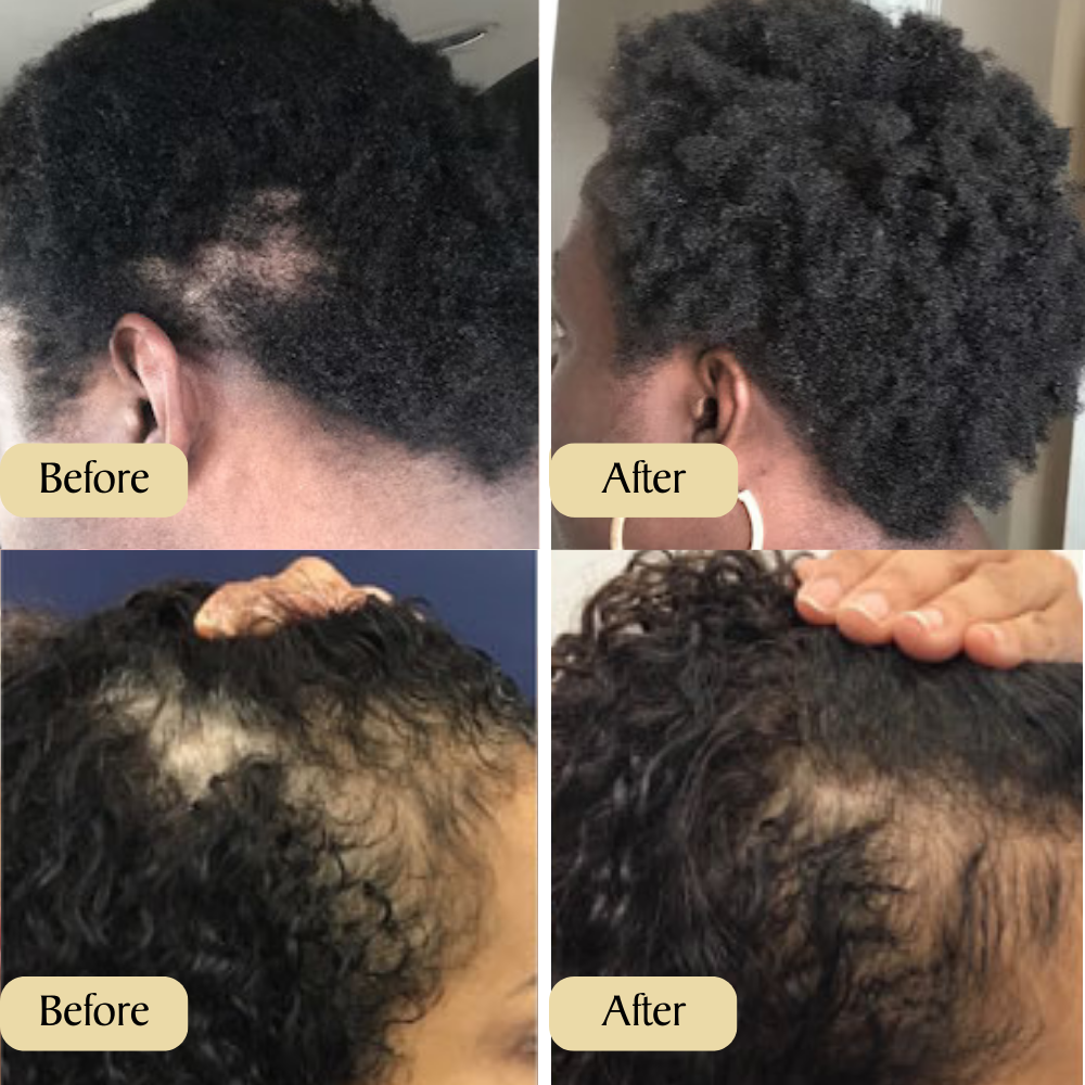 Lanneve Veganic™ Natural Oil for Hair Growth