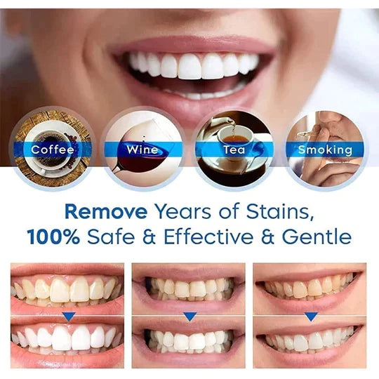 SmileShield® Haven (BUY 1 GET 1 FREE)