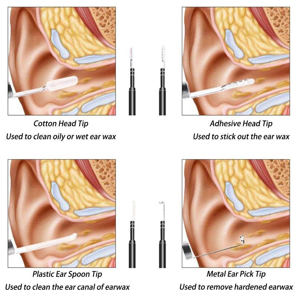 Earwax Cleaner™