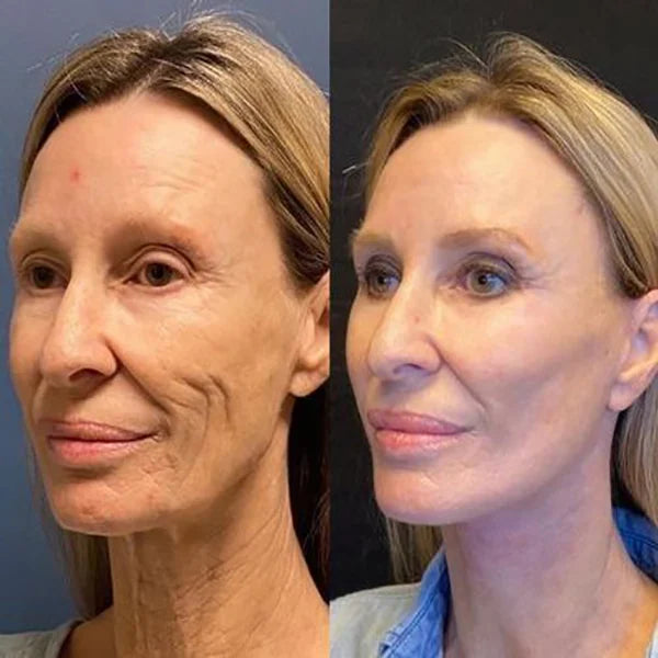 Anti-Aging Collagen™ (70% OFF)