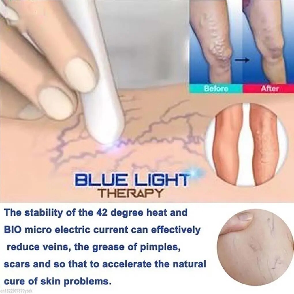 ReviveSkin: Anti-Varicose Veins Removal Pen