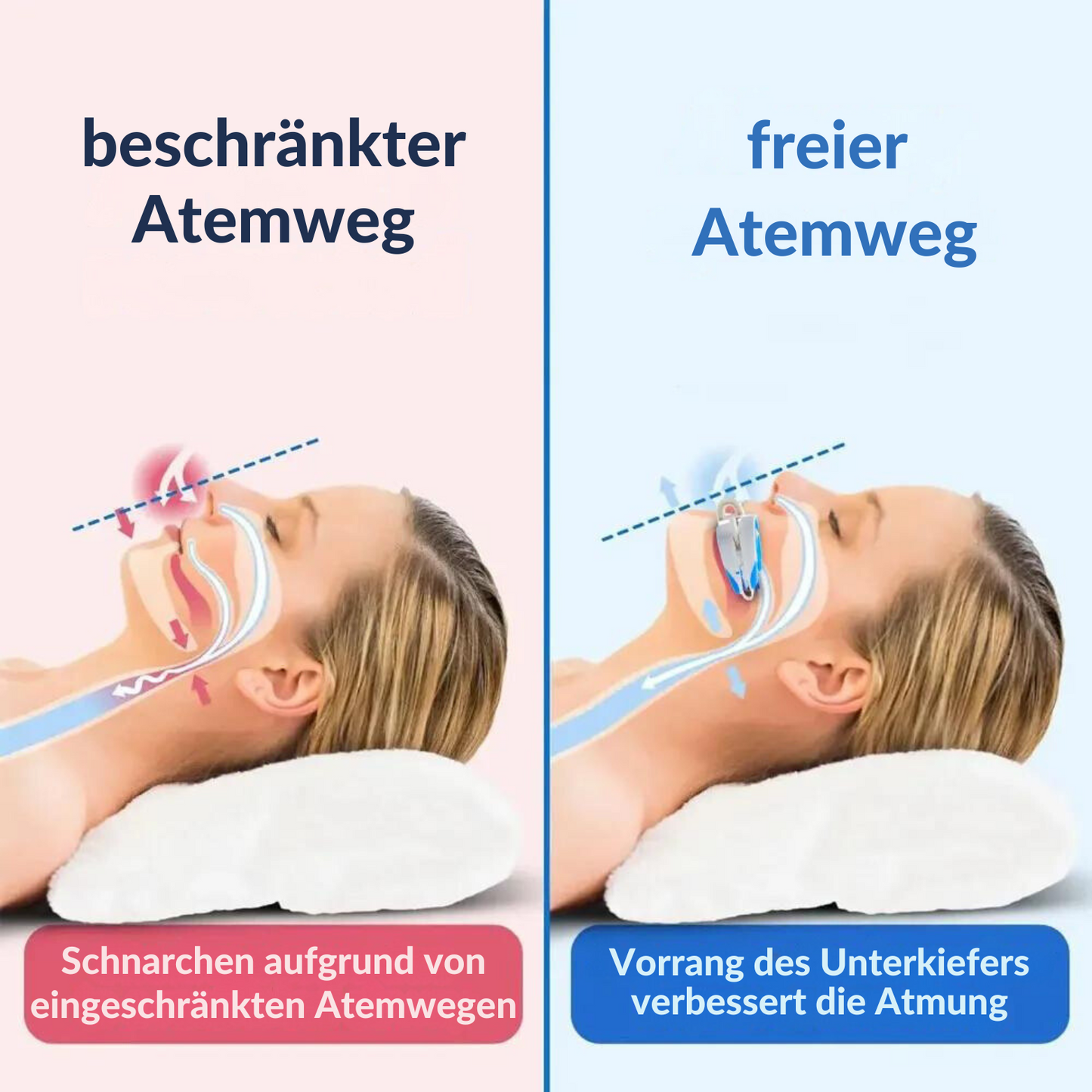Anti Schnarch-Schiene
