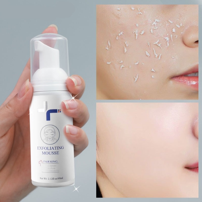 Foaming Exfoliating Mousse Deep Remove Cleaning All Skin