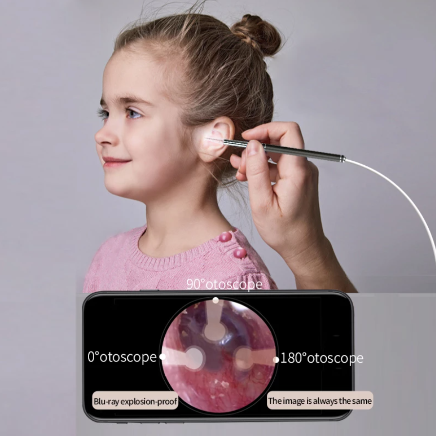 Earwax Cleaner™