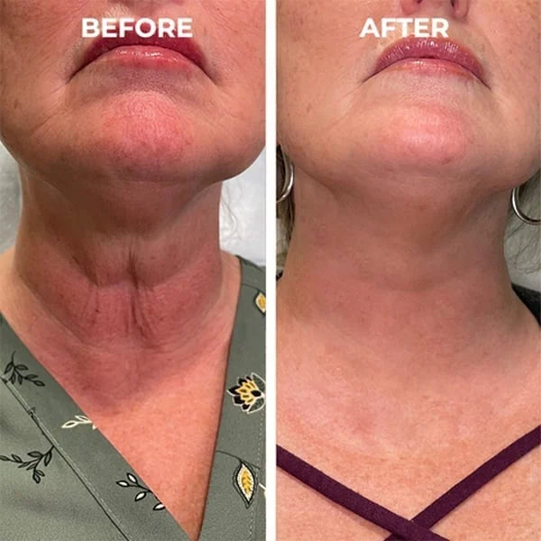 Anti-Aging Collagen™ (70% OFF)