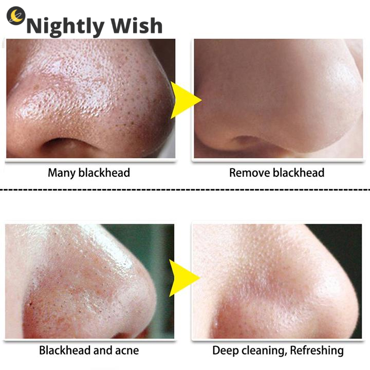 Blackhead Deep Cleansing Mask