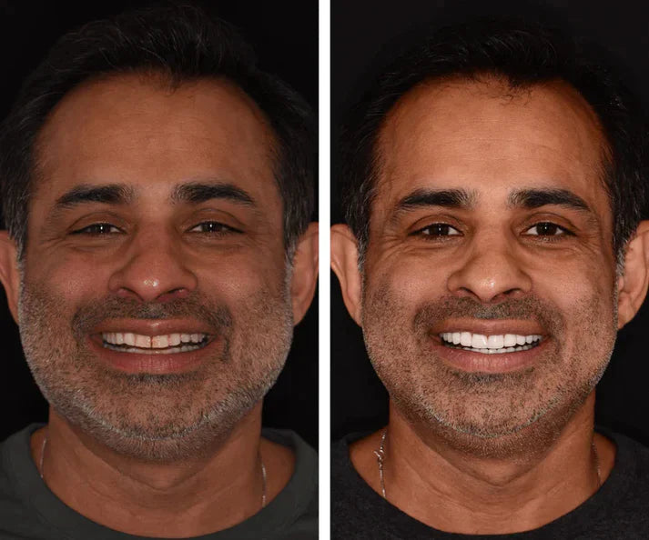 Elegiar Smile Oil Blend
