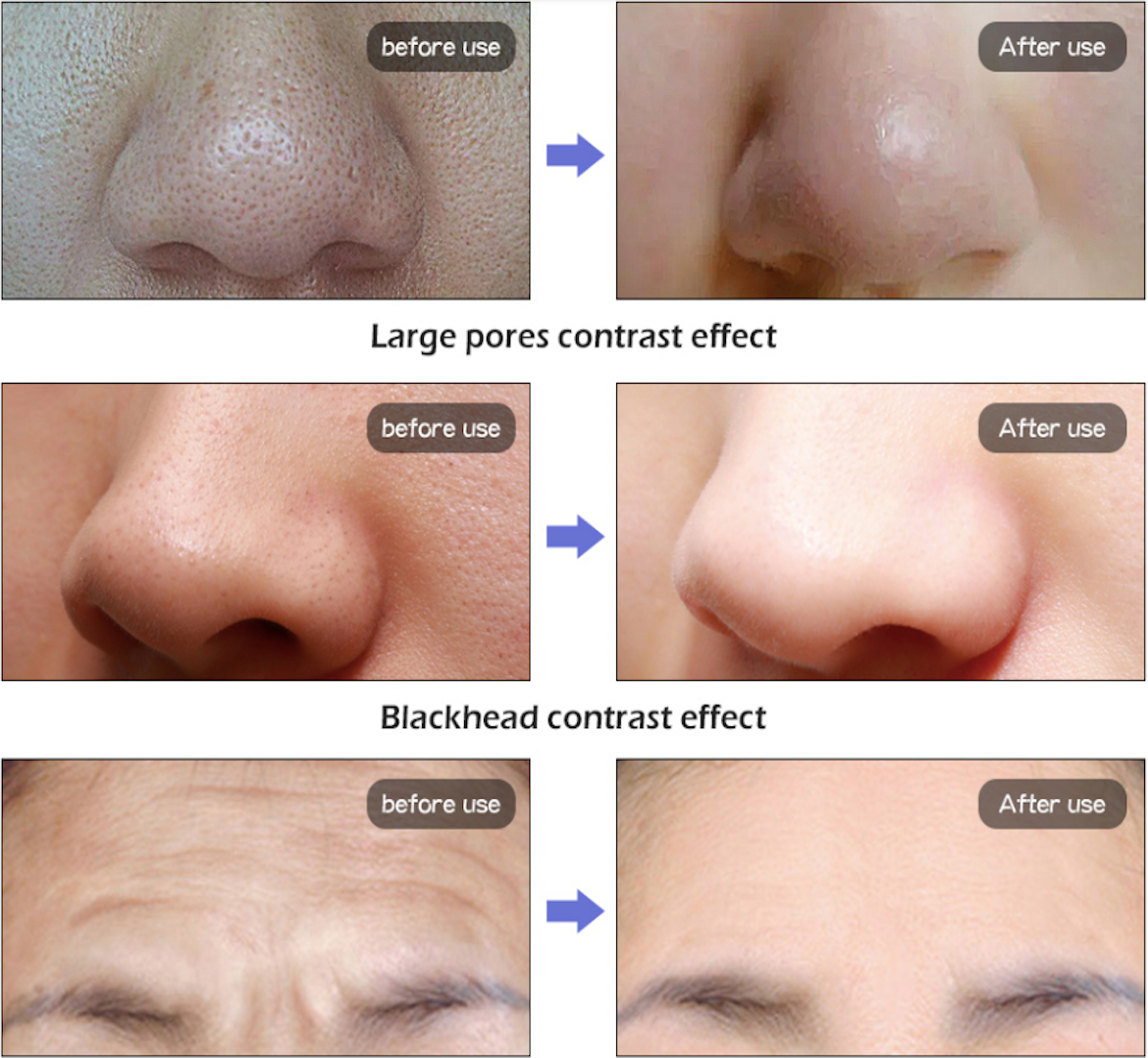 SkinSavior™