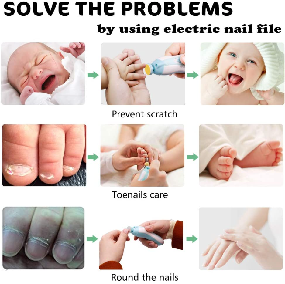 Electric Nail Trimmer™