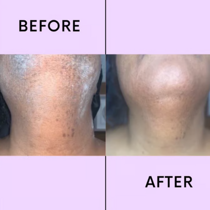 SereniSilk™ — Reveal Silky, Stubble-Free Skin That Boosts Your Confidence Instantly