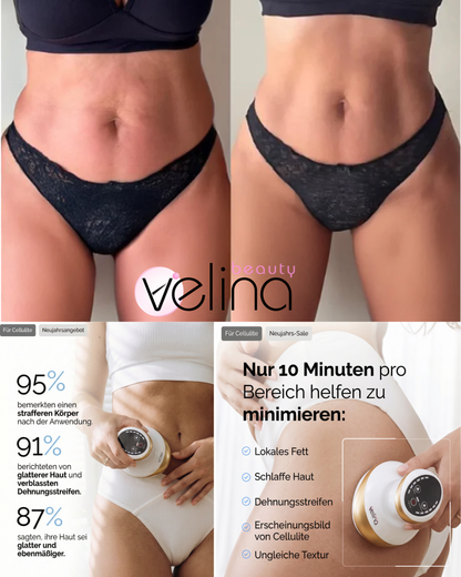 BodySculpt™ | Sculpt Gerät für glattere und straffere Haut