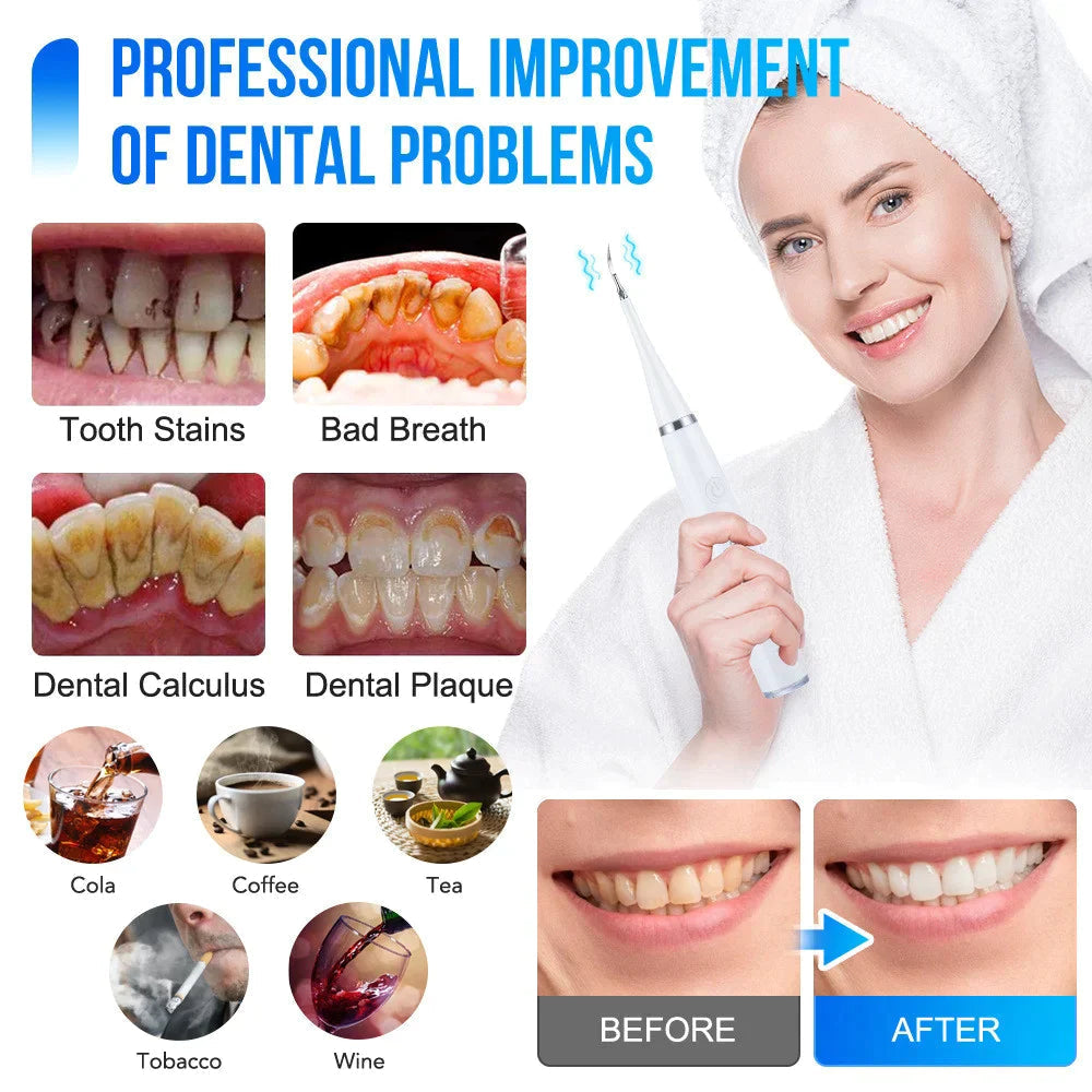 SmilePulse™ — Effortless Deep Cleaning for a Radiant, Confident Smile Every Day