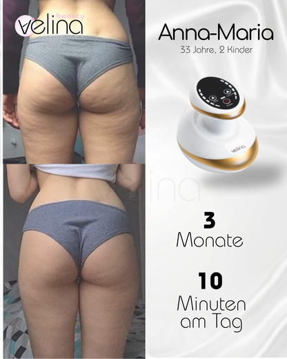 BodySculpt™ | Sculpt Gerät für glattere und straffere Haut