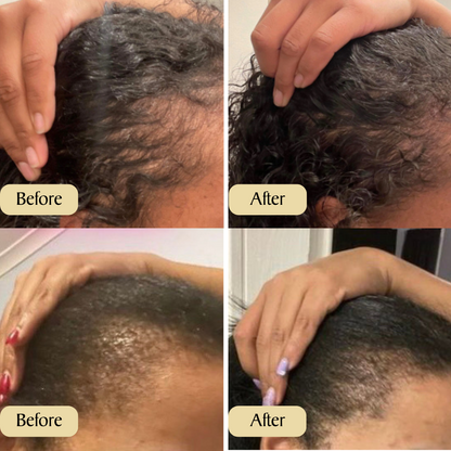 Lanneve Veganic™ Natural Oil for Hair Growth