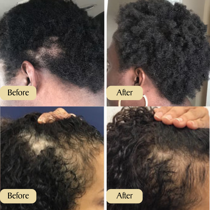 Lanneve Veganic™ Natural Oil for Hair Growth