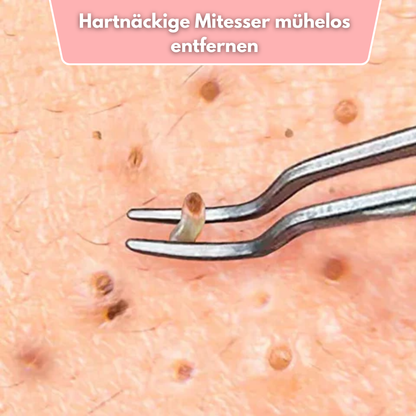 ClearPore™ – Mitesser-Pinzetten-Entferner-Set, präzise, effektiv, sicher & hygienisch [1 + 1 Gratis]