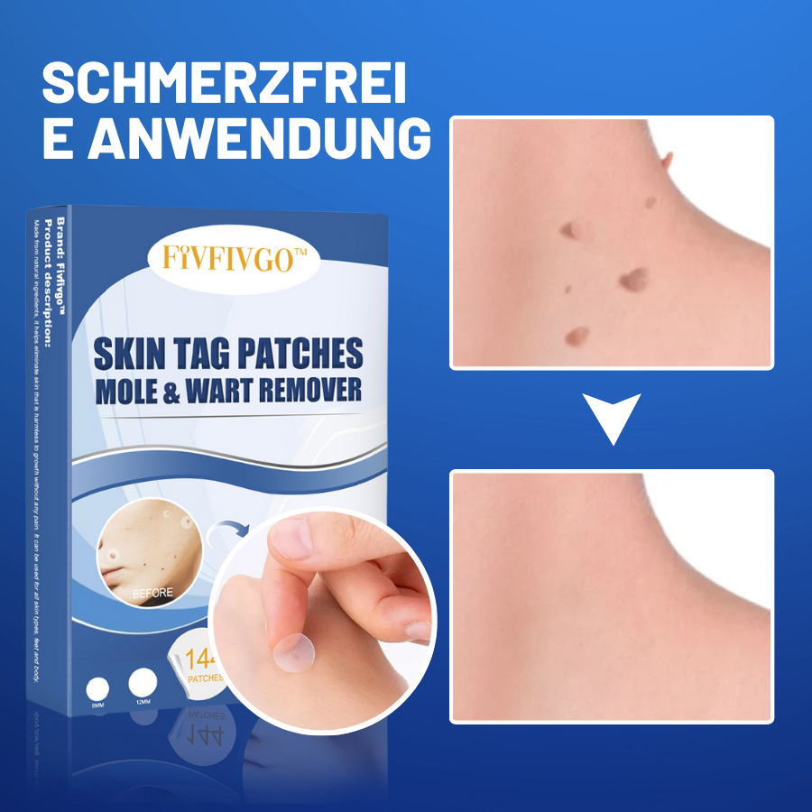 TagAway™ – Entfernt Hautanhängsel schmerzlos, mühelos und sicher [50% Rabatt]