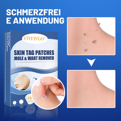 TagAway™ – Entfernt Hautanhängsel schmerzlos, mühelos und sicher [50% Rabatt]