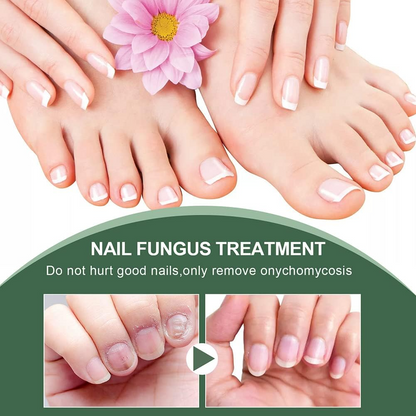 ClearStep™ — Step Confidently with Clear, Strong Nails That Demand Attention