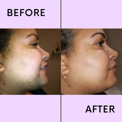 SereniSilk™ — Reveal Silky, Stubble-Free Skin That Boosts Your Confidence Instantly