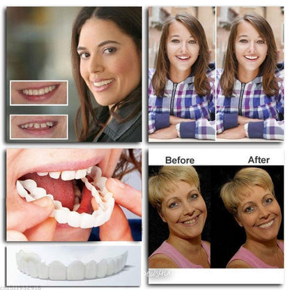 SnapSmile™ – Bequeme und sichere Zahnprothesen für ein strahlendes Lächeln [50% Rabatt]