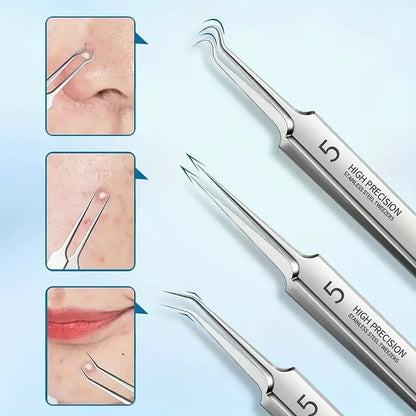 ClearPore™ – Mitesser-Pinzetten-Entferner-Set, präzise, effektiv, sicher & hygienisch [1 + 1 Gratis]