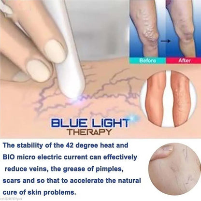 ReviveSkin: Anti-Varicose Veins Removal Pen