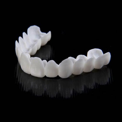 SmileSnap | Directe Veneer Transformatie Kit voor Esthetische Tandbedekking