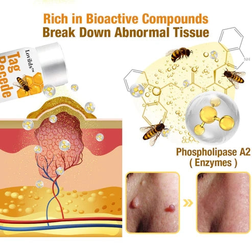 TagAway - Effective removal of warts and skin growths