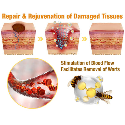 TagAway - Effective removal of warts and skin growths