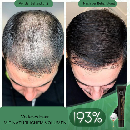 Regrowth™ – Bio-Haar-Serum-Roller für gesundes, kräftiges und glänzendes Haar [1 + 1 Gratis]