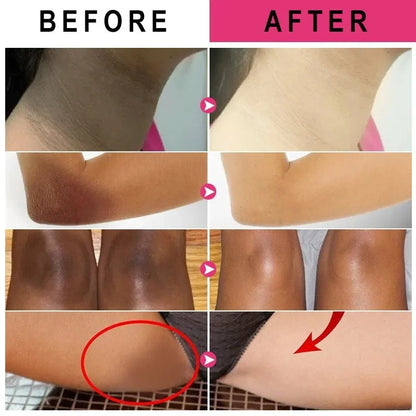 Snow Bleach: Natural Skin Tone Restoration for Bikini, Perianal, Vaginal, & Underarm Areas - Boost Confidence for Beach Outings & Intimate Moments.