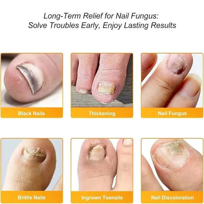 FungalPatch™ – Antibakterieller, schimmelhemmender Patch für effektive Nagelpflege [50% Rabatt]