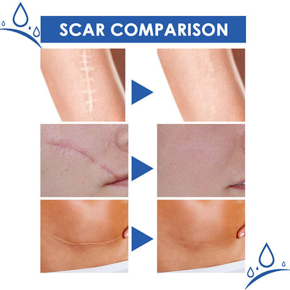 DermalSync™ – Für Narbenreduzierung, Straffung, Pflege, Regeneration & glattere Haut [50% Rabatt]