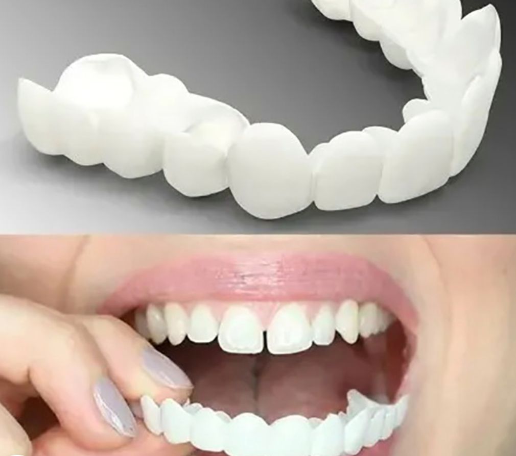 Snap-On Dentures with Adjustable Fit
