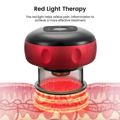 Electric Cupping Therapy Jar
