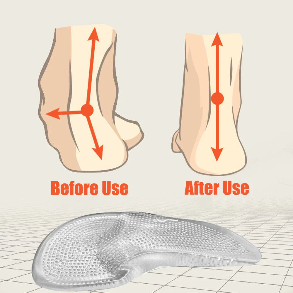 Orthopädische Silikongel-Einlagen für Fußschmerzen und Plattfüße