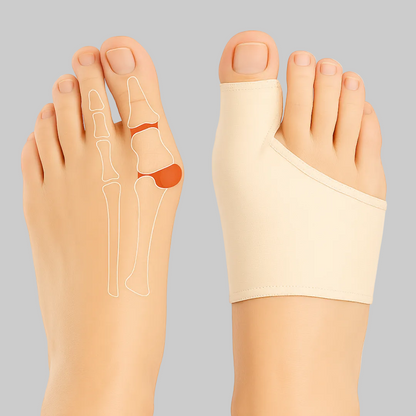 Lagoz Bunion Corrector met Gelpads - Tenen Spreider Hallux Valgus