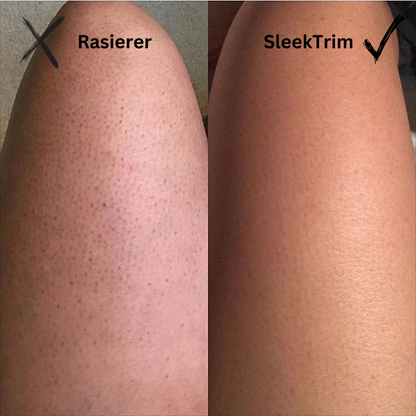 SleekTrim