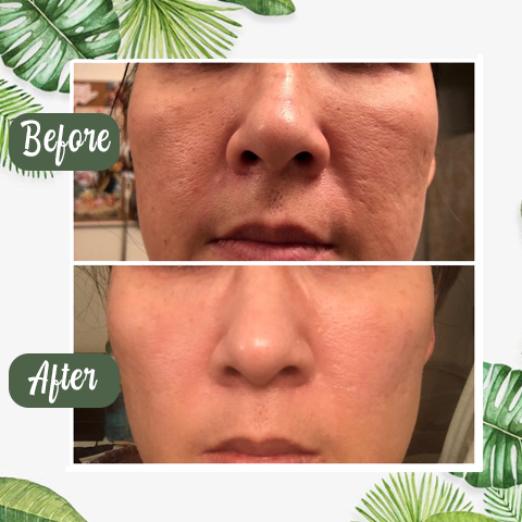 PurifyMist™ — Unleash Clear, Radiant Skin That Glows with Confidence