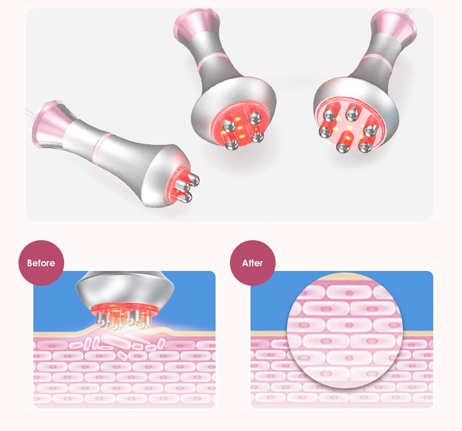 80K 5 IN 1 Ultrasonic Cavitation Machine