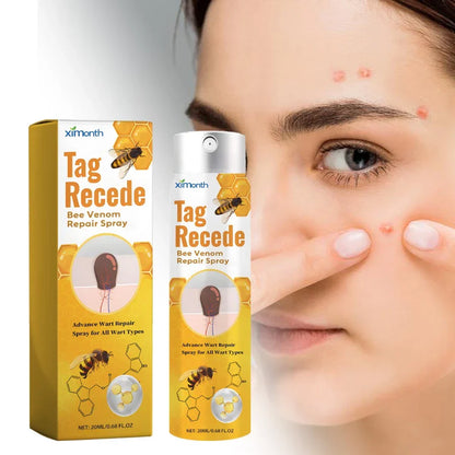 TagAway - Effective removal of warts and skin growths