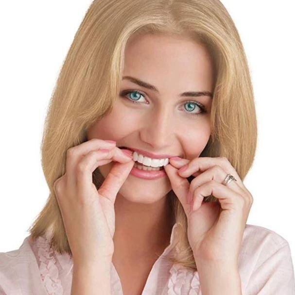 SnapSmile™ – Bequeme und sichere Zahnprothesen für ein strahlendes Lächeln [50% Rabatt]
