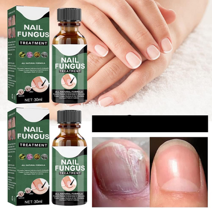 ClearStep™ — Step Confidently with Clear, Strong Nails That Demand Attention