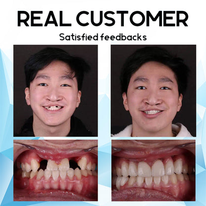 SmileNest™ — Rediscover Joy with a Denture Fit So Natural It Feels Like You Again