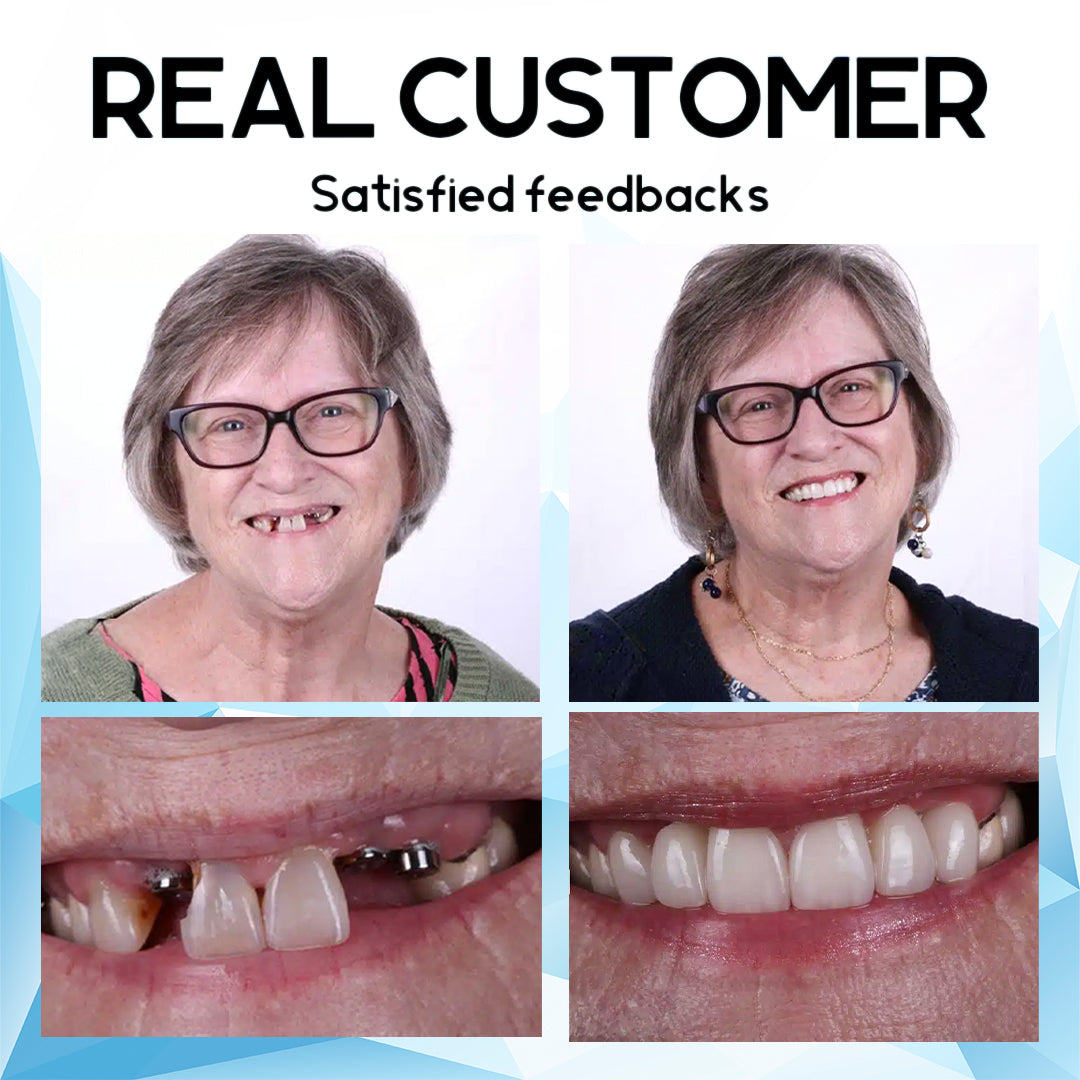 SmileNest™ — Rediscover Joy with a Denture Fit So Natural It Feels Like You Again