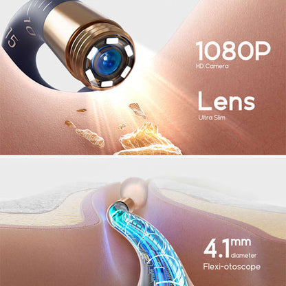 TILLFÄLLIGT 50% OFF | EarVue™