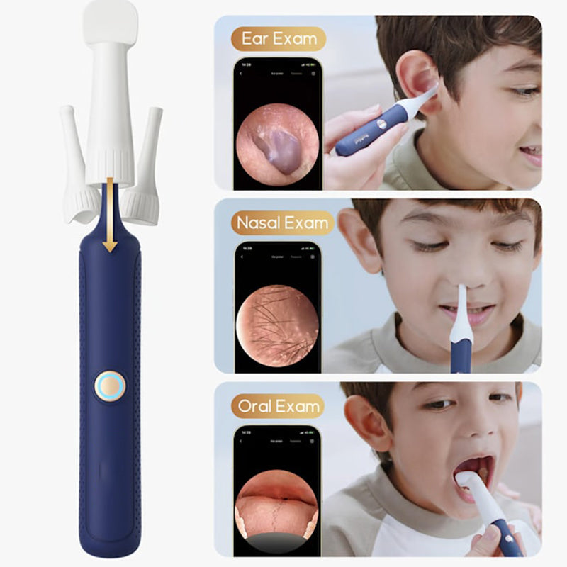 TILLFÄLLIGT 50% OFF | EarVue™