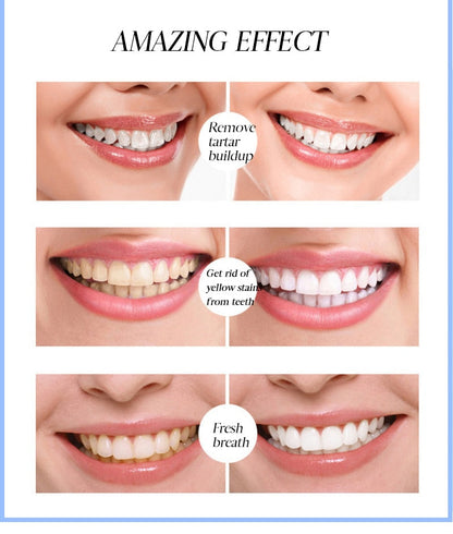 BrightSmilez™ Teeth whitening pen