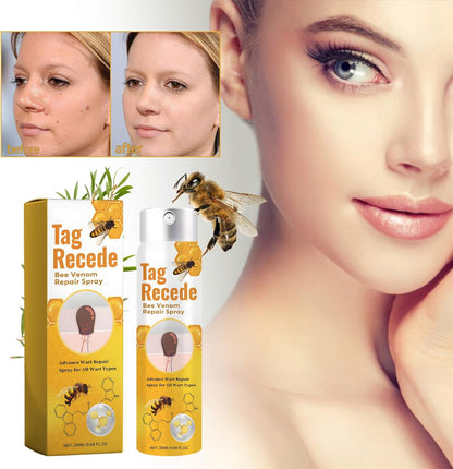 TagAway™ – Effektive Entfernung von Warzen und Hautwucherungen schnell und sicher [50% Rabatt]